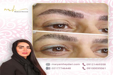 بهترین مرکز فیبروز ابرو در تهران آکادمی فیبروز مریم حیدری