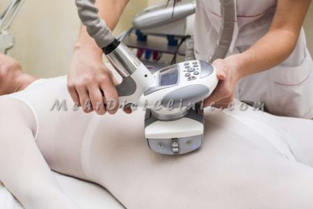 لاغری موضعی با دستگاه ال پی جی