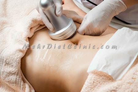 فروش پکیج دستگاه لاغری
