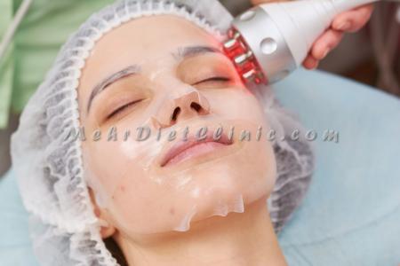 دستگاه لاغری آر اف RF چربی سوز صورت