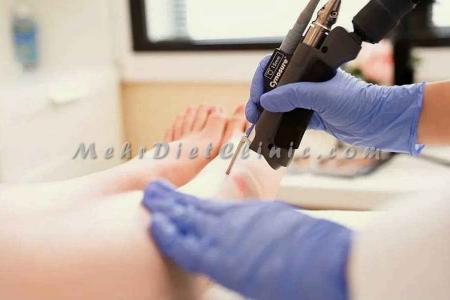 قیمت آمپول لاغری اسپارتینا